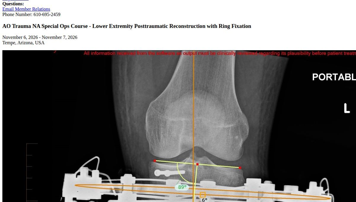 AO Trauma NA Special Ops Course – Lower Extremity Posttraumatic Reconstruction with Ring Fixation